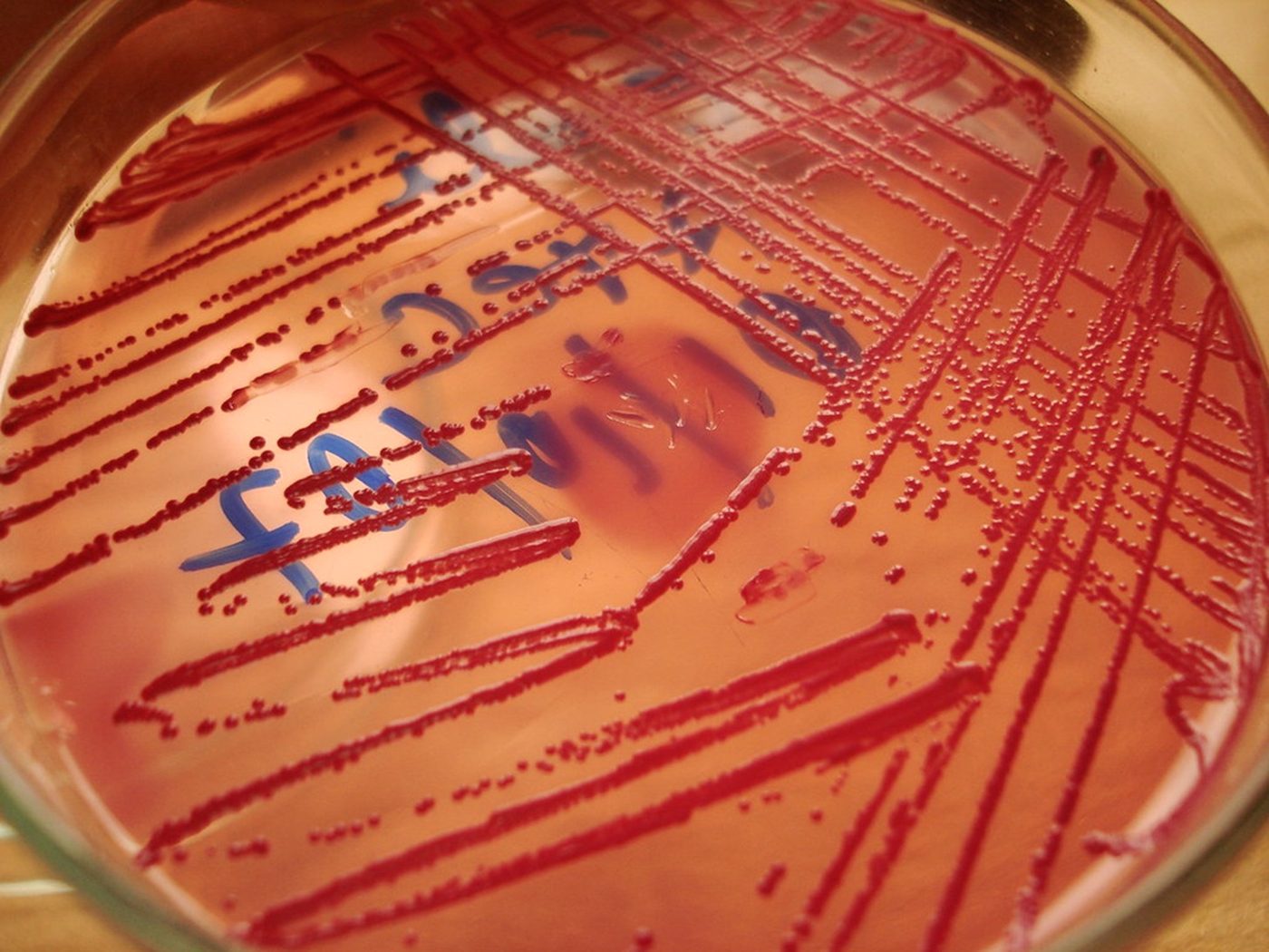 Placa de Petri con las colonias crecidas para el análisis microbiológico del agua